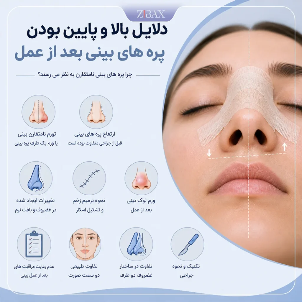 بالا و پایین بودن پره های بینی بعد از عمل