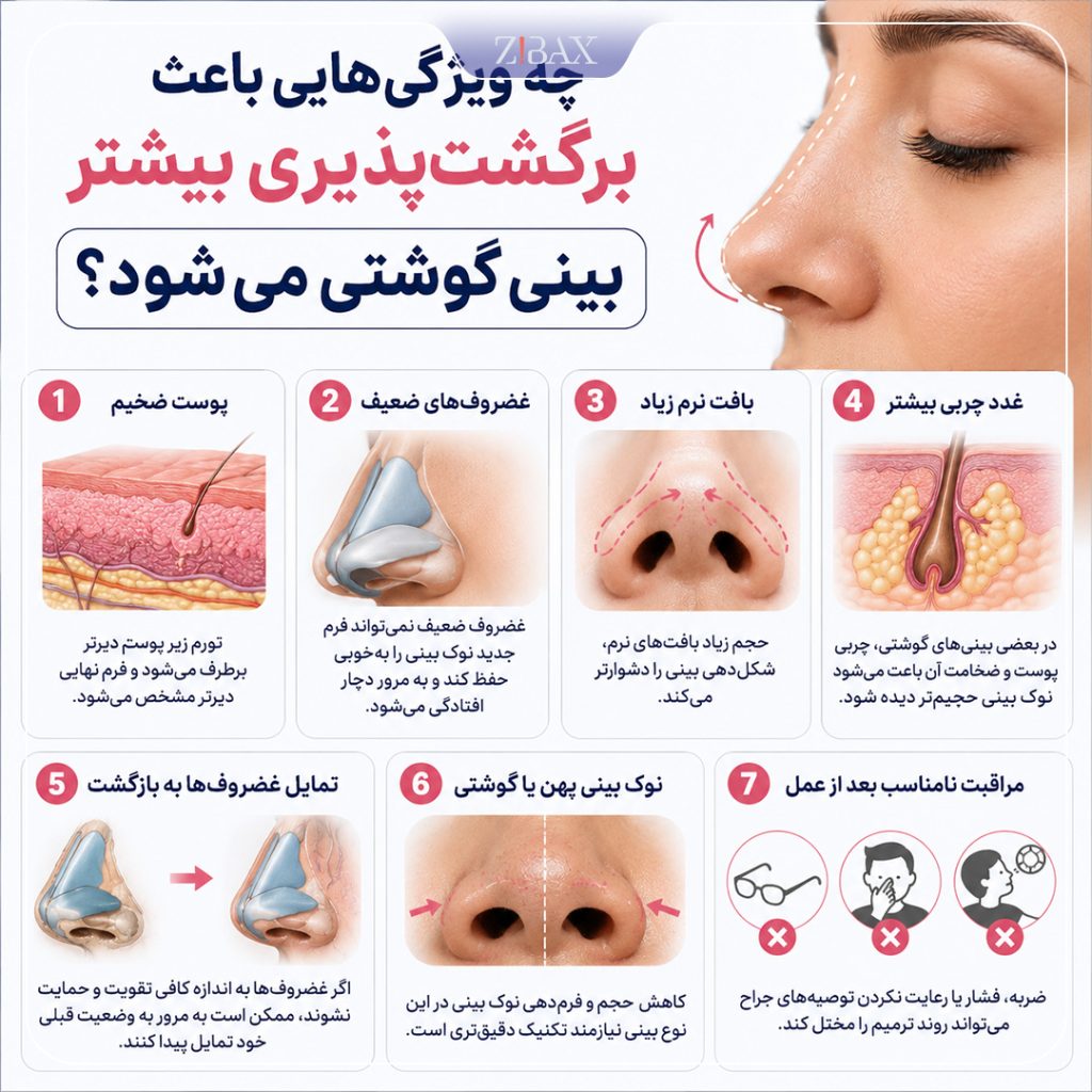 ویژگی های برگشت بینی گوشتی