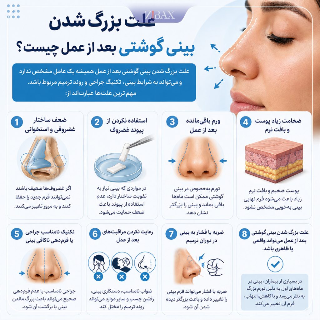 علت بزرگ شدن بینی گوشتی بعد از عمل