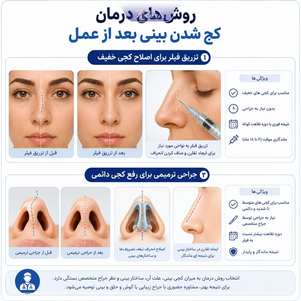 روش های درمان کج شدن بینی بعد از عمل