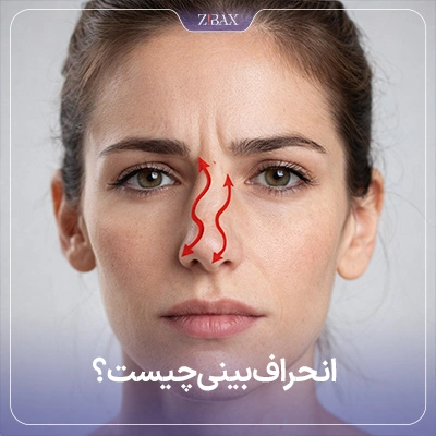 انحراف بینی چیست؟