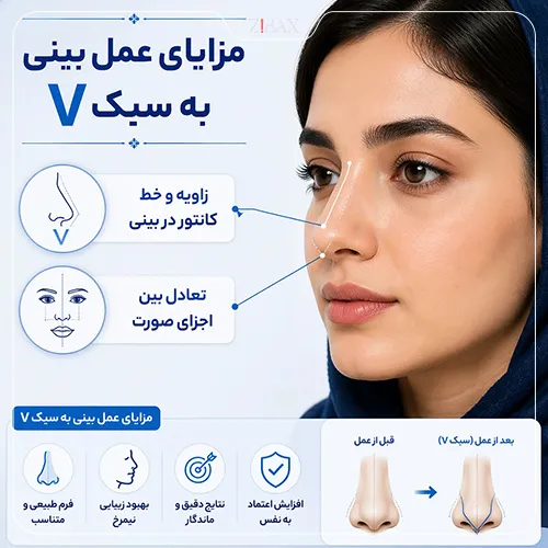بررسی مزایا و نکات مثبت عمل بینی به سبک v