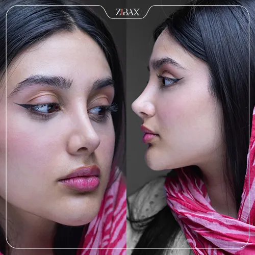 نمونه کار خط کانتور در عمل بینی در مجوعه زیباکس