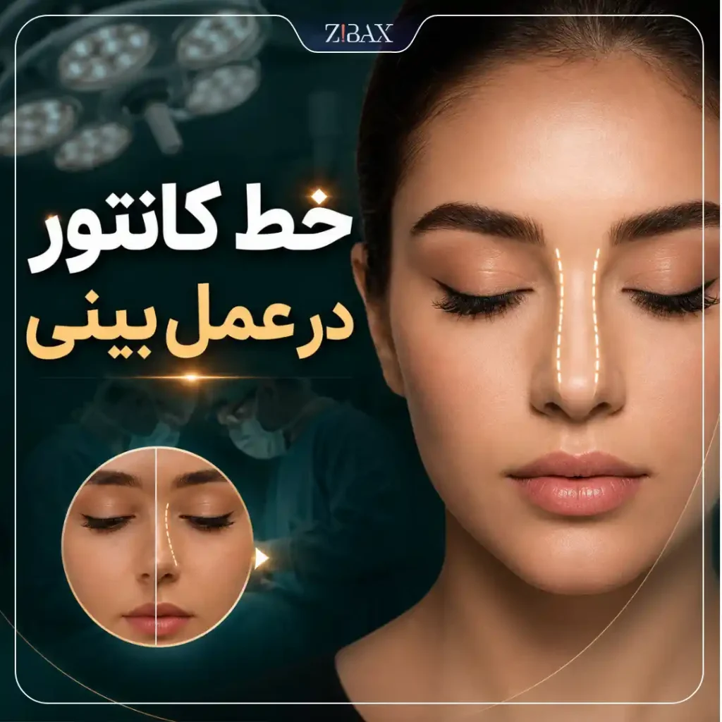 خط کانتور در عمل بینی