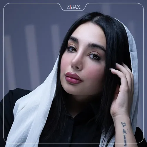 عکس نمونه عمل بینی با خط کانتور در مجموعه زیباکس