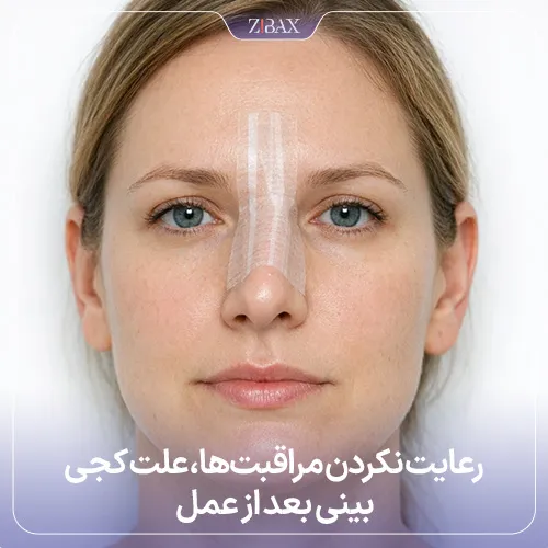 رعایت نکردن مراقبت‌ها از دلایل اصلی کجی بینی بعد از جراحی