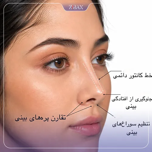مشخصات و ویژگی‌های جراحی بینی به سبک v