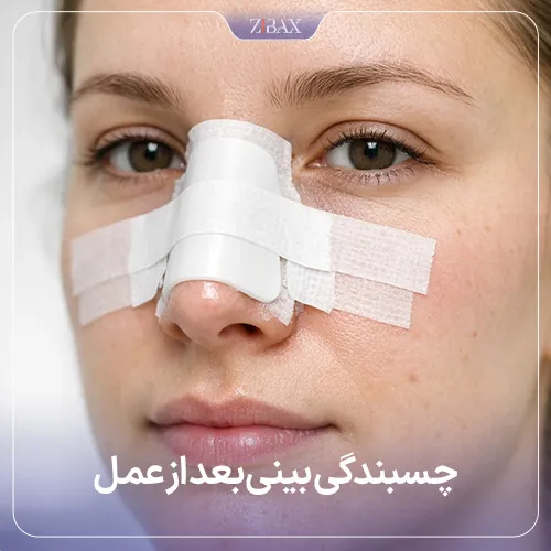 چسبندگی بینی بعد از عمل