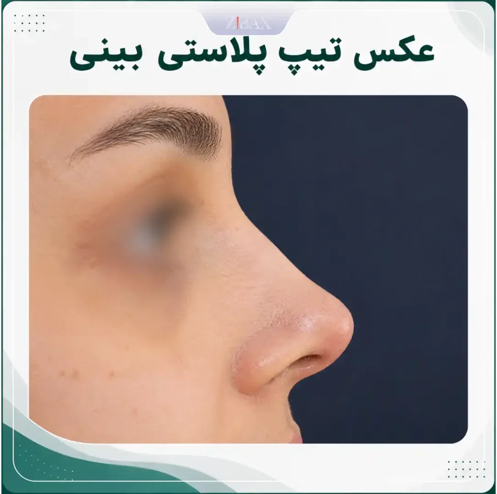 عکس تیپ پلاستی بینی