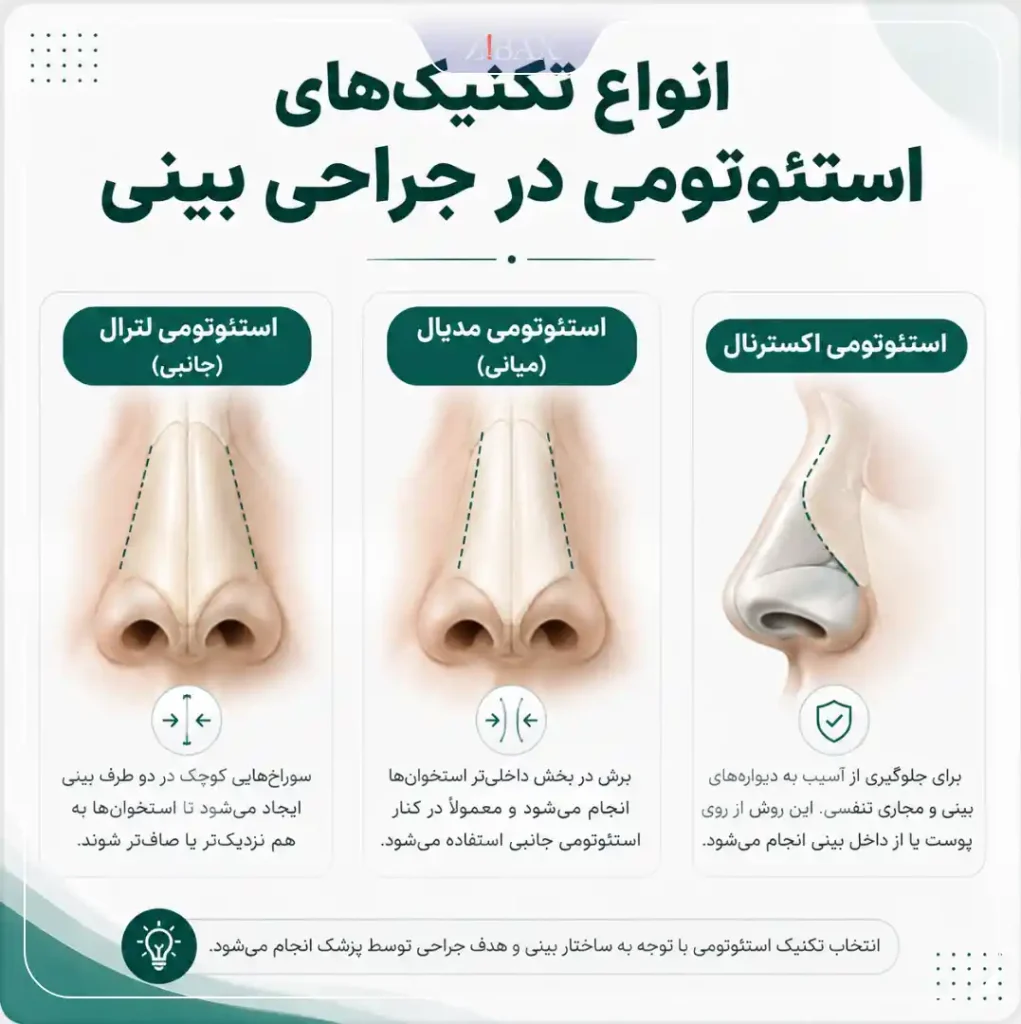 تکنیک های استئوتومی بینی