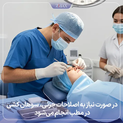 سوهان کشی بینی در مطب