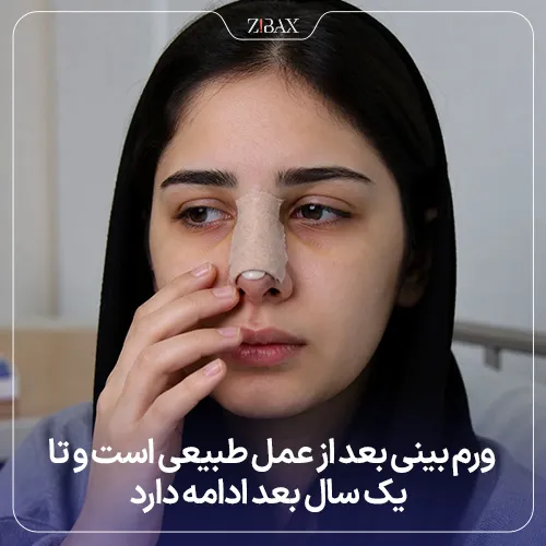 تفاوت برگشت بینی گوشتی بعد از عمل با ورم بینی