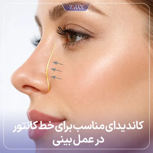 بررسی کاندیداتوری مناسب برای جراحی خط کانتور بینی