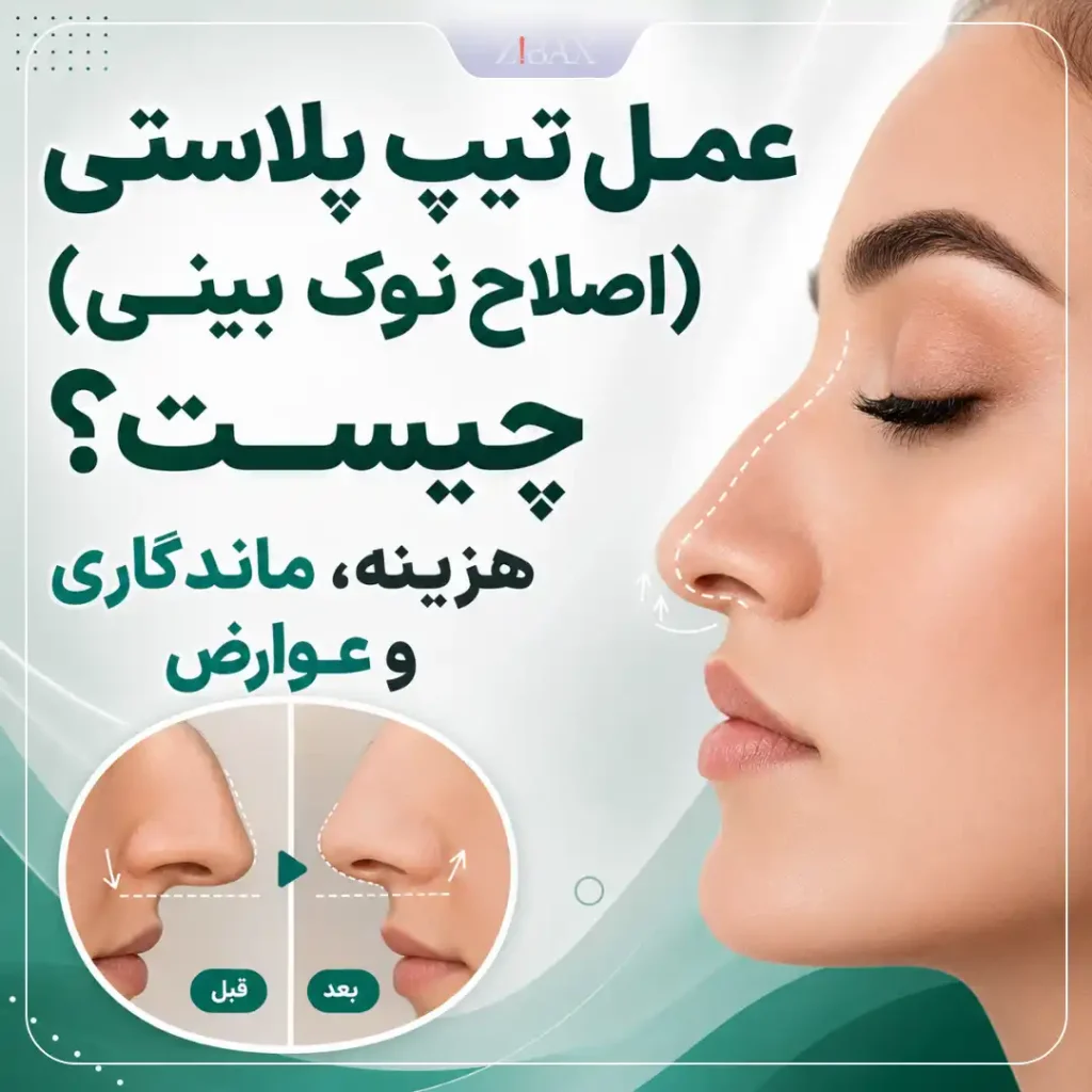 تیپ پلاستی بینی