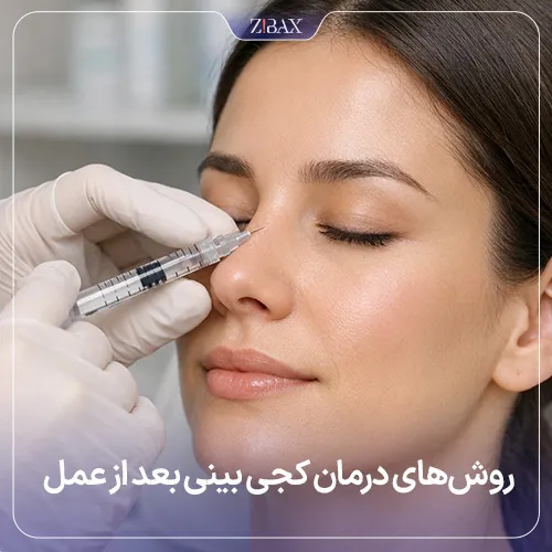 روش‌های درمان کجی بینی بعد از جراحی بینی