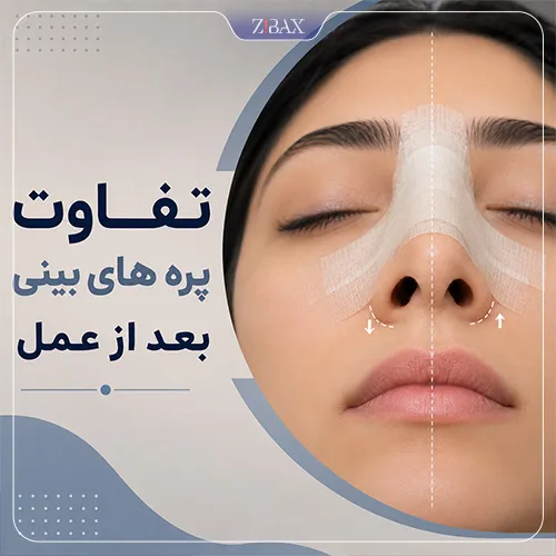 تفاوت پره های بینی بعد از عمل