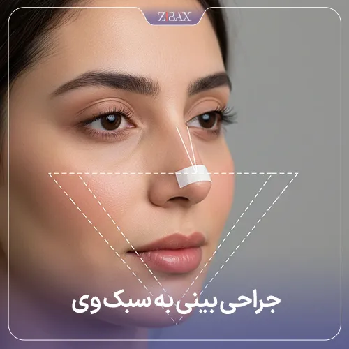 جراحی بینی به سبک v