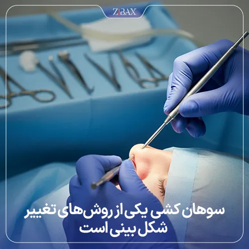 مفهوم دقیق سوهان کشی بینی