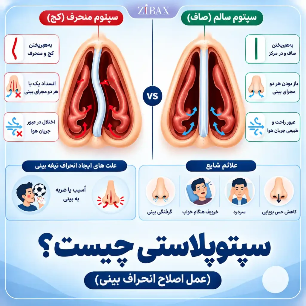 جراحی سپتوپلاستی چیست