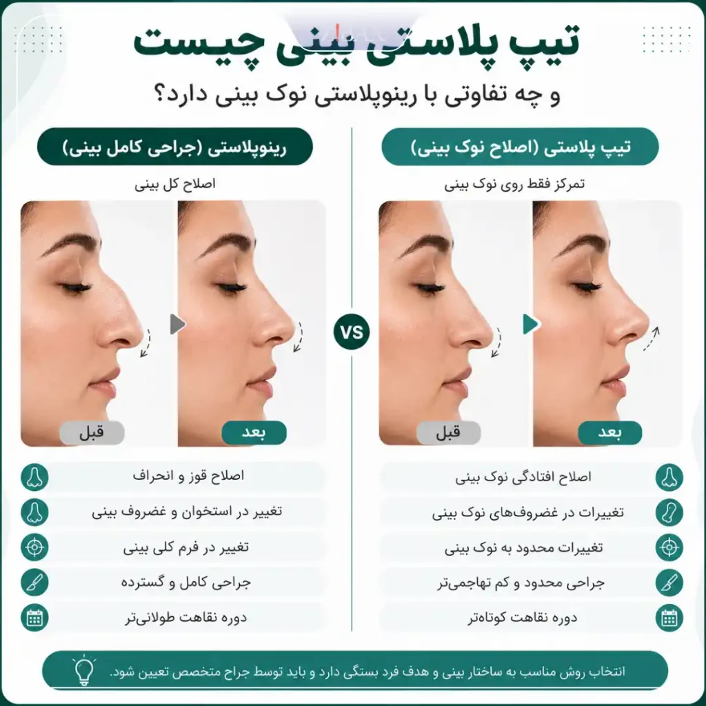 تیپ پلاستی بینی چیست