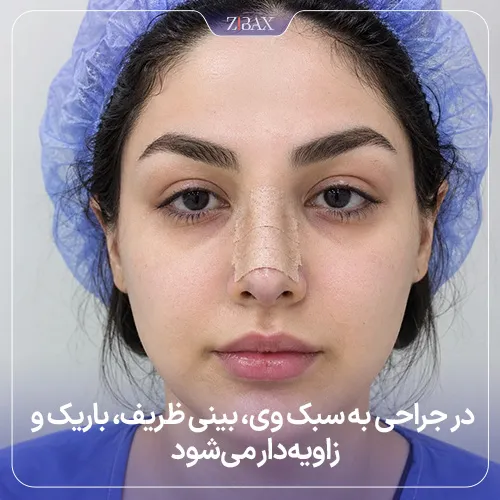 مفهوم جراحی بینی به سبک V