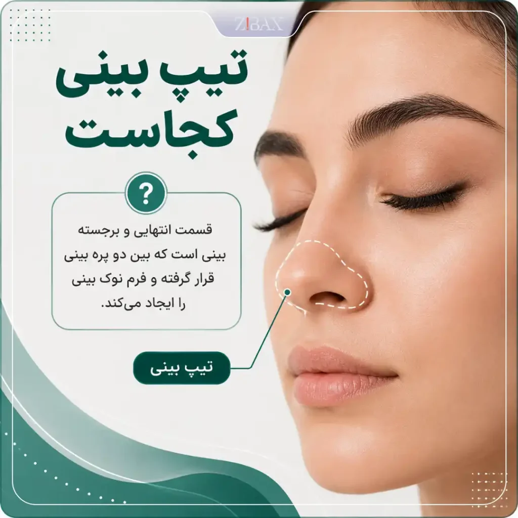 تیپ بینی کجاست