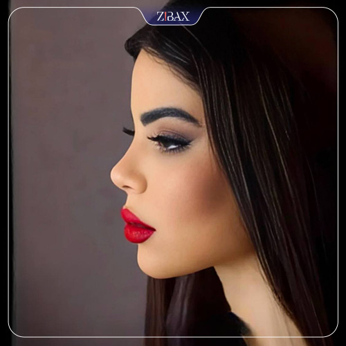 نمونه عمل جراحی بینی دکتر اکبر اعتمادی — تصویر 8