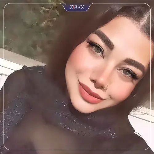 نمونه عمل جراحی بینی دکتر ماندانا فاوجی — تصویر 9