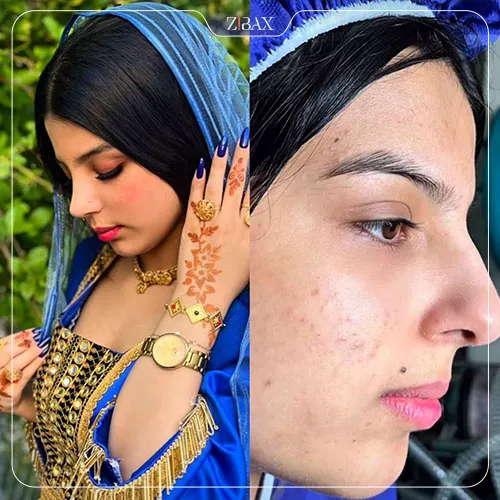 نمونه عمل جراحی بینی دکتر ماندانا فاوجی — تصویر 10