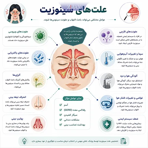 چرا سینوزیت میگیریم