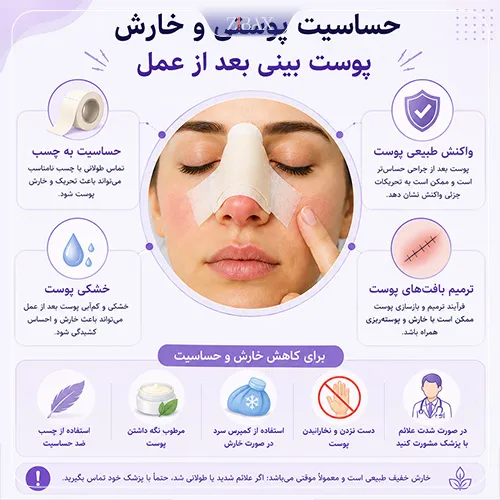 حساسیت پوستی بعد از عمل بینی