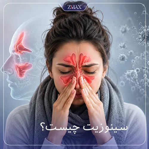 سینوزیت چیست؟
