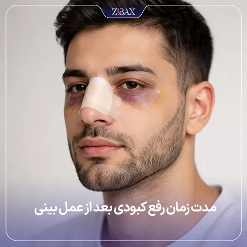مدت زمان کبودی بعد از عمل بینی