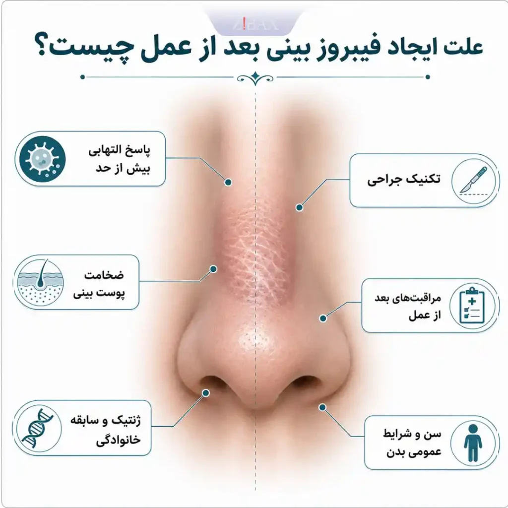 علت ورم فیبروز بینی