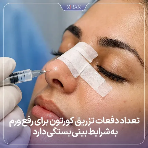 تاثیر تزریق کورتون برای کاهش تورم بعد از عمل بینی