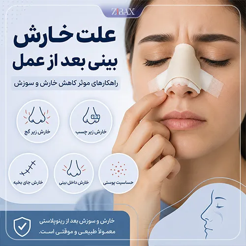 علت خارش بینی بعد از عمل؛ مجله زیباکس