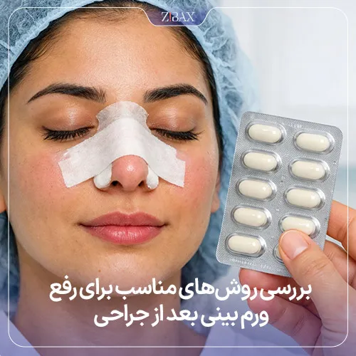 بهترین روش از بین بردن ورم بینی بعد از عمل