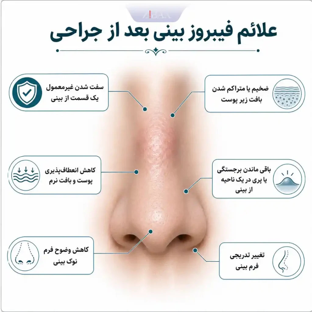 علائم فیبروز بینی