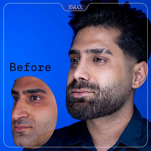 نمونه کار عمل بینی ۱۰