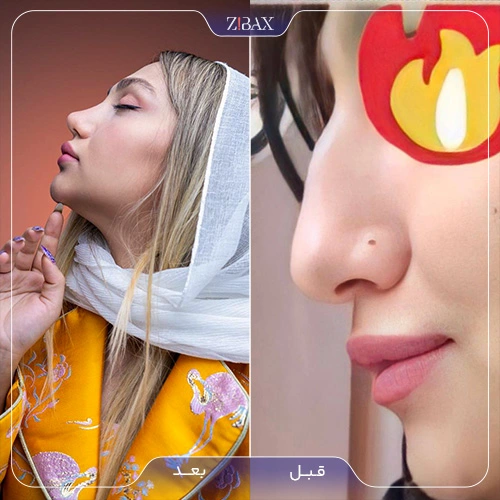 نمونه کار عمل بینی ۱