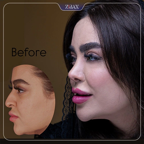 نمونه کار عمل بینی ۸