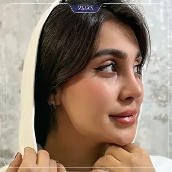 نمونه عمل جراحی بینی دکتر غلامرضا کدخدایی الیادرانی — تصویر 5
