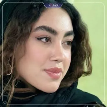 نمونه عمل جراحی بینی دکتر غلامرضا کدخدایی الیادرانی — تصویر 6