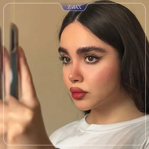 نمونه عمل جراحی بینی دکتر احسان شفیعی — تصویر 2