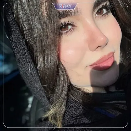 نمونه عمل جراحی بینی دکتر احسان شفیعی — تصویر 5
