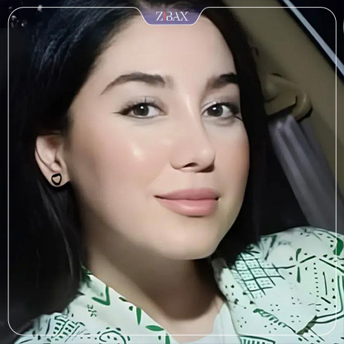 نمونه عمل جراحی بینی دکتر حمیدرضا حسنانی — تصویر 10