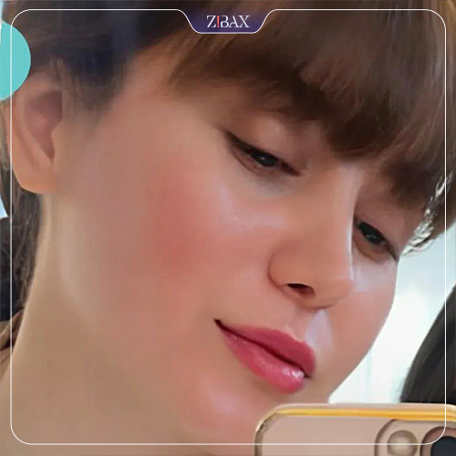 نمونه عمل جراحی بینی دکتر حمیدرضا حسنانی — تصویر 4