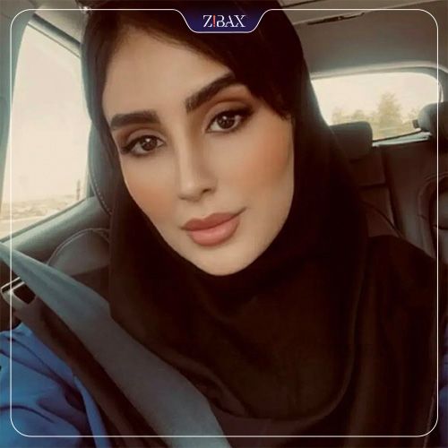 نمونه عمل جراحی بینی دکتر حمیدرضا حسنانی — تصویر 6