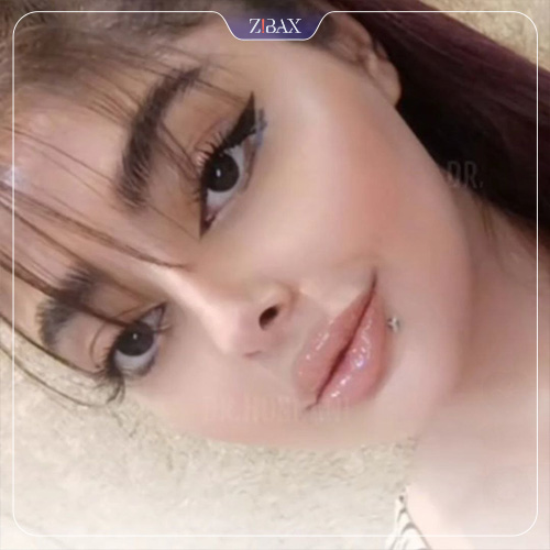 نمونه عمل جراحی بینی دکتر حمیدرضا حسنانی — تصویر 7