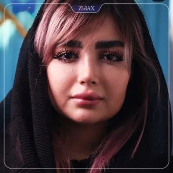 نمونه عمل جراحی بینی دکتر محمد مجیدی — تصویر 7